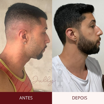 visagismo masculino online - antes e depois