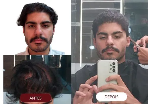 visagismo masculino online - antes e depois - consultoria de imagem
