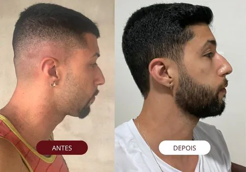 visagismo masculino online - antes e depois - consultoria de imagem