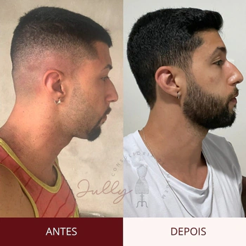 visagismo masculino online - antes e depois