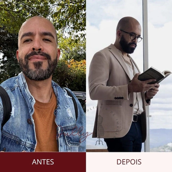 visagismo masculino online - antes e depois