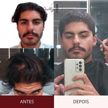 visagismo masculino online - antes e depois